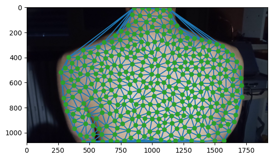 Delaunay triangulation over points tracked on a subject's back
