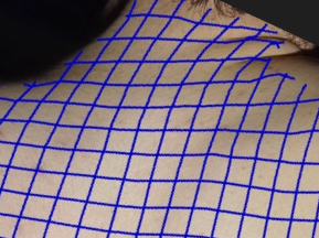 Tracked back skin showing skew during shoulder movement