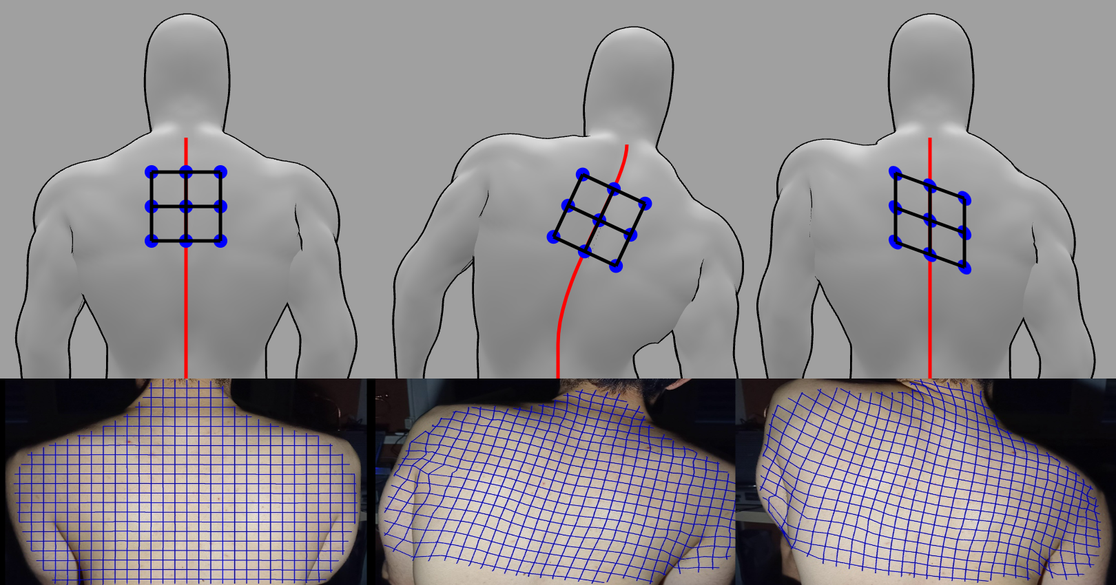 Comparison of hypothesized and observed back-skin skew during shoulder movement