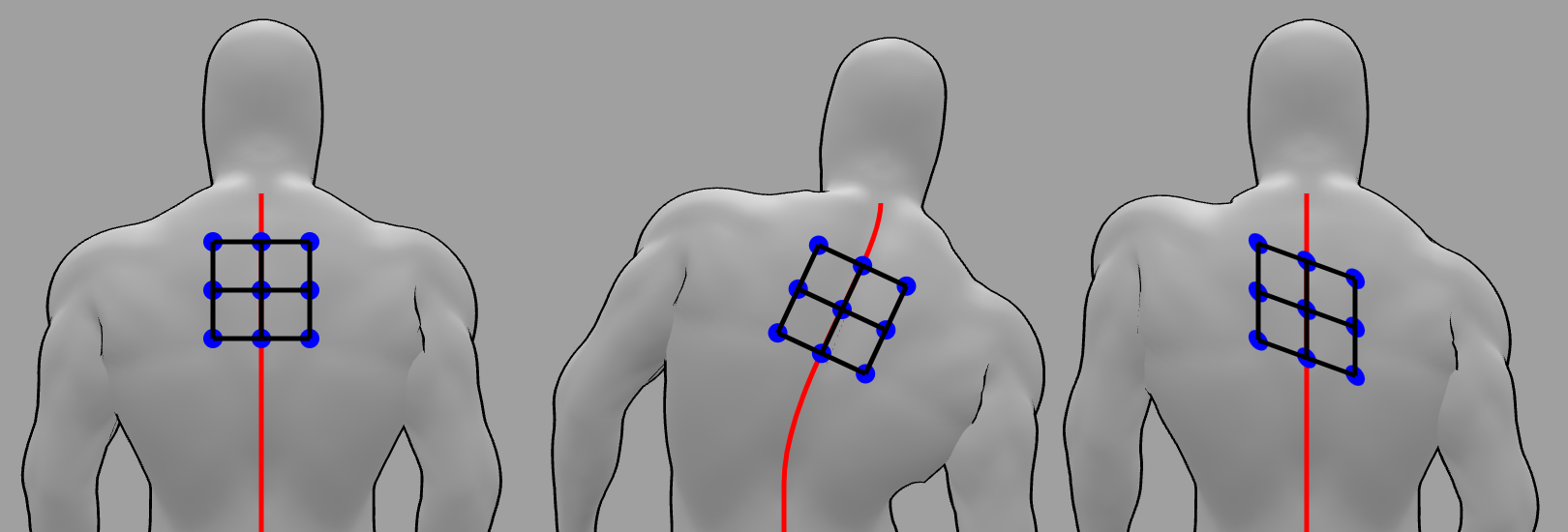 Diagram of the hypothesized skin deformation during different shoulder movements